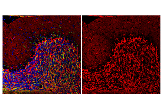 Immunofluorescence Image 1: AQP4 (D1F8E) XP® Rabbit mAb (Alexa Fluor® 647 Conjugate)