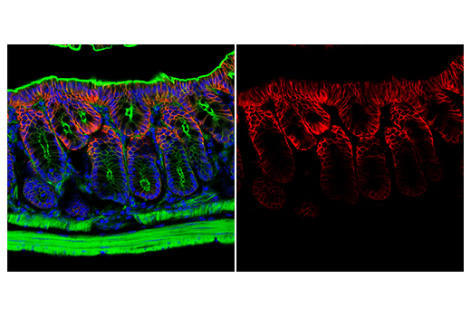 Immunofluorescence Image 2: AQP4 (D1F8E) XP® Rabbit mAb (Alexa Fluor® 647 Conjugate)