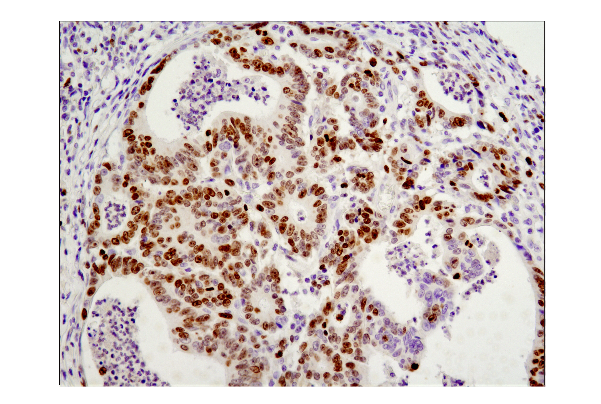 Immunohistochemistry Image 2: Ki-67 (D2H10) Rabbit mAb