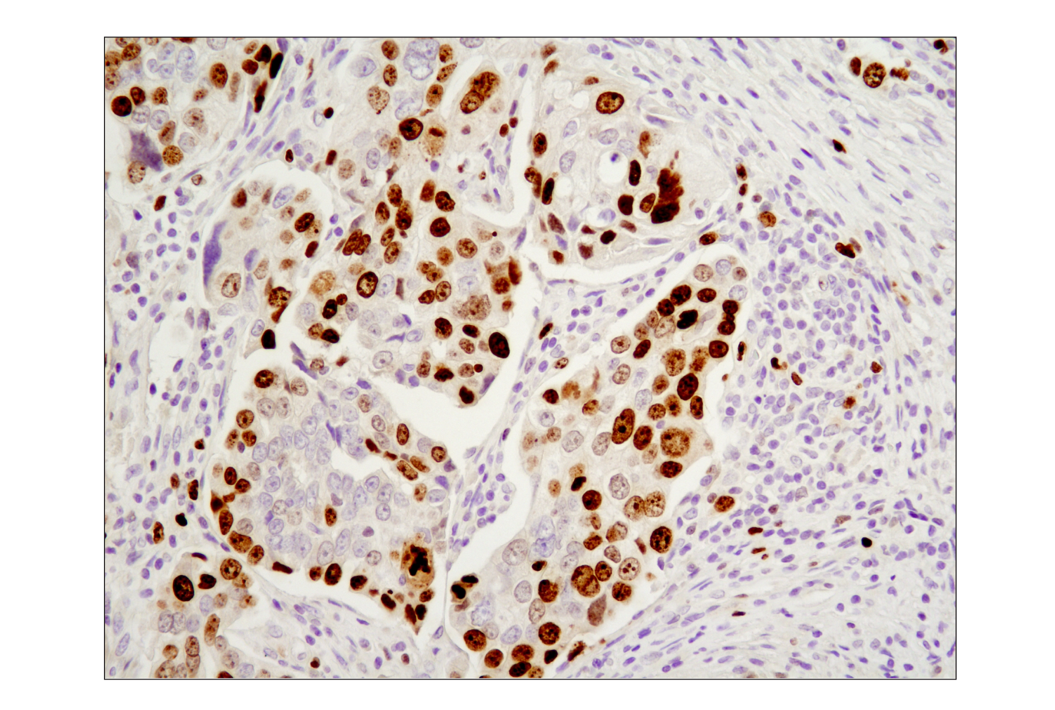 Immunohistochemistry Image 3: Ki-67 (D2H10) Rabbit mAb