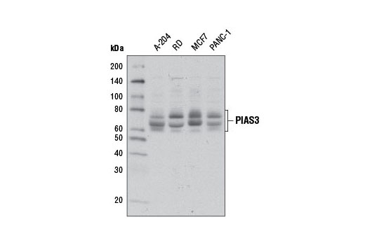  Image 12: Jak/Stat Pathway Inhibitors Antibody Sampler Kit