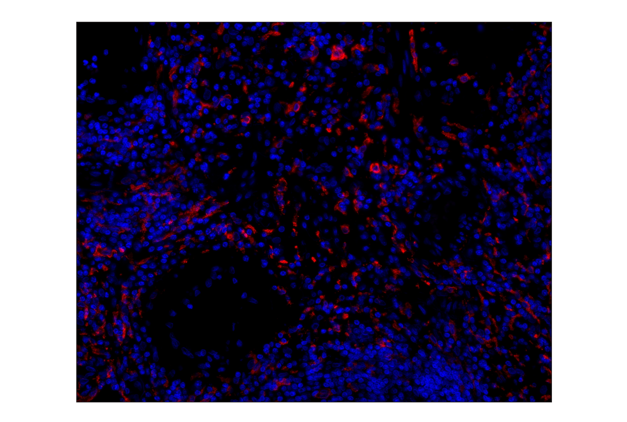 Immunohistochemistry Image 1: CD163 (D6U1J) Rabbit mAb (Alexa Fluor® 555 Conjugate)