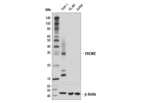  Image 24: TREM2 Signaling Pathways Antibody Sampler Kit