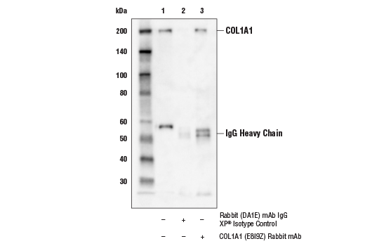  Image 21: TGF-β Fibrosis Pathway Antibody Sampler Kit