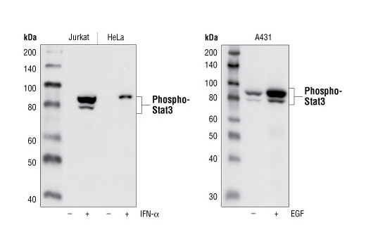  Image 16: ALK Activation Antibody Sampler Kit