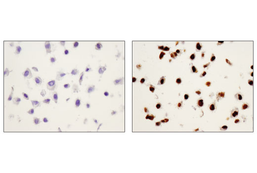  Image 41: Human Reactive M1 vs M2 Macrophage IHC Antibody Sampler Kit