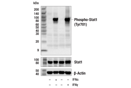  Image 7: Human Reactive M1 vs M2 Macrophage IHC Antibody Sampler Kit