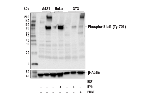 Western Blotting Image 2: Phospho-Stat1 (Tyr701) (58D6) Rabbit mAb