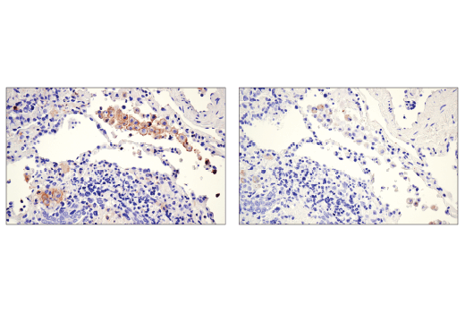  Image 54: Human Reactive M1 vs M2 Macrophage IHC Antibody Sampler Kit