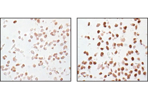  Image 47: Cannabinoid Receptor 1 Downstream Signaling Antibody Sampler Kit