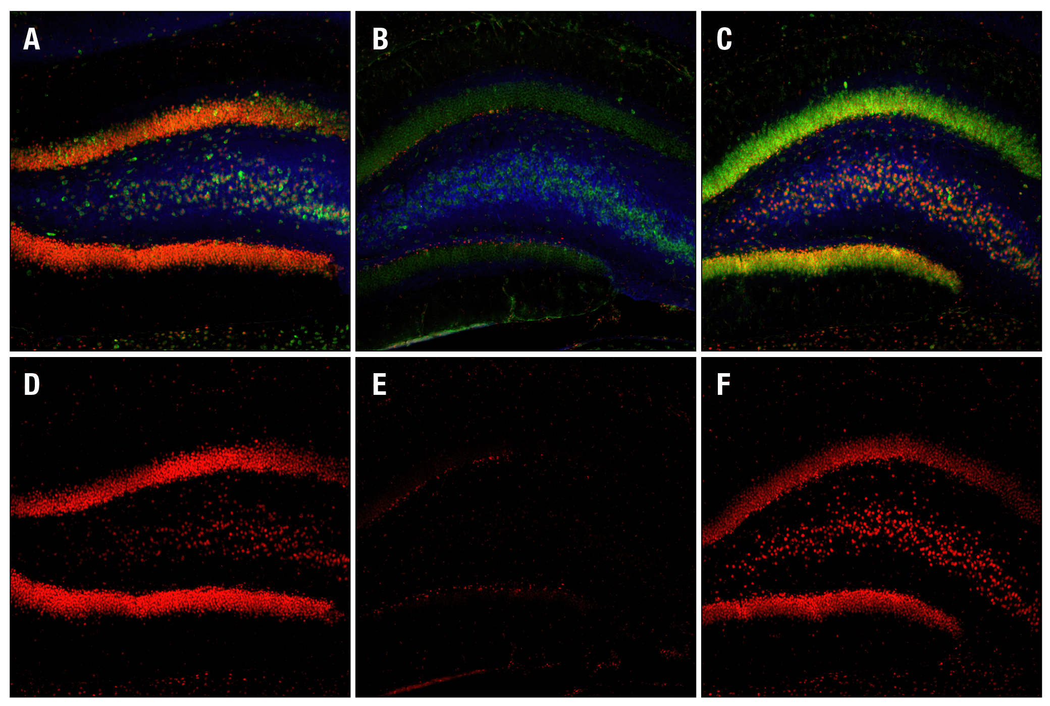 Immunofluorescence Image 1: Phospho-CREB (Ser133) (87G3) Rabbit mAb