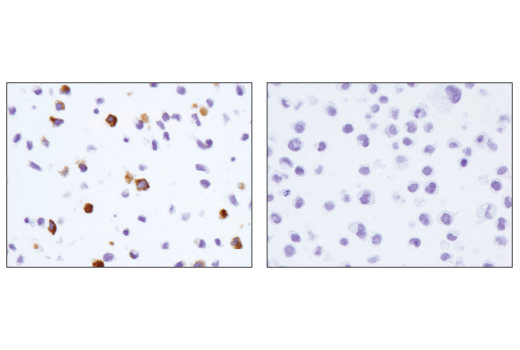  Image 27: Suppressive Myeloid Cell Phenotyping IHC Antibody Sampler Kit