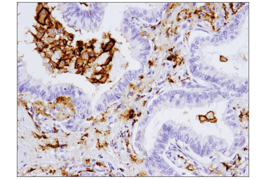  Image 36: Human Reactive M1 vs M2 Macrophage IHC Antibody Sampler Kit