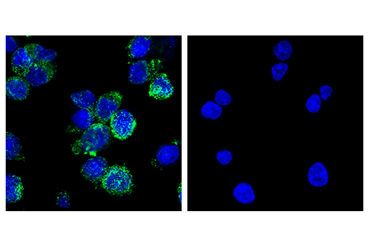  Image 48: Human Reactive M1 vs M2 Macrophage IHC Antibody Sampler Kit