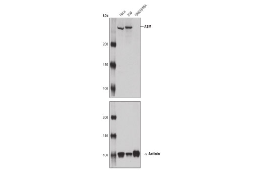 Western Blotting Image 1: ATM (11G12) Mouse mAb