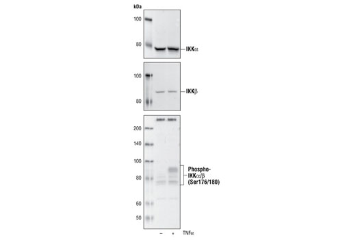 Western Blotting Image 1: NF-κB Control Cell Extracts