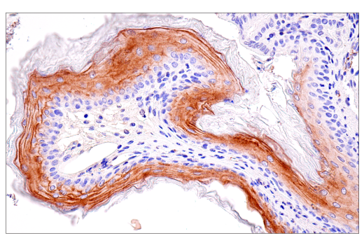 Immunohistochemistry Image 11: ACE2 (E5O6J) XP® Rabbit mAb