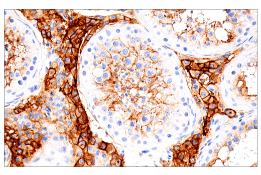 Immunohistochemistry Image 2: ACE2 (E5O6J) XP® Rabbit mAb