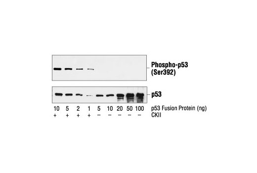  Image 8: p53 Antibody Sampler Kit