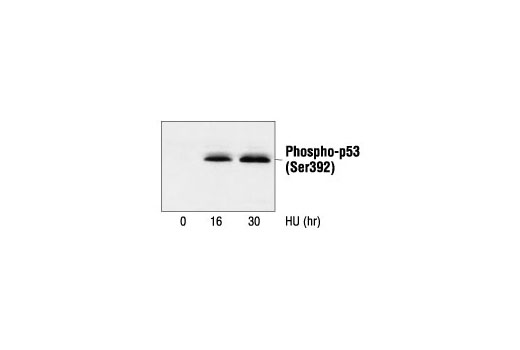  Image 16: p53 Antibody Sampler Kit