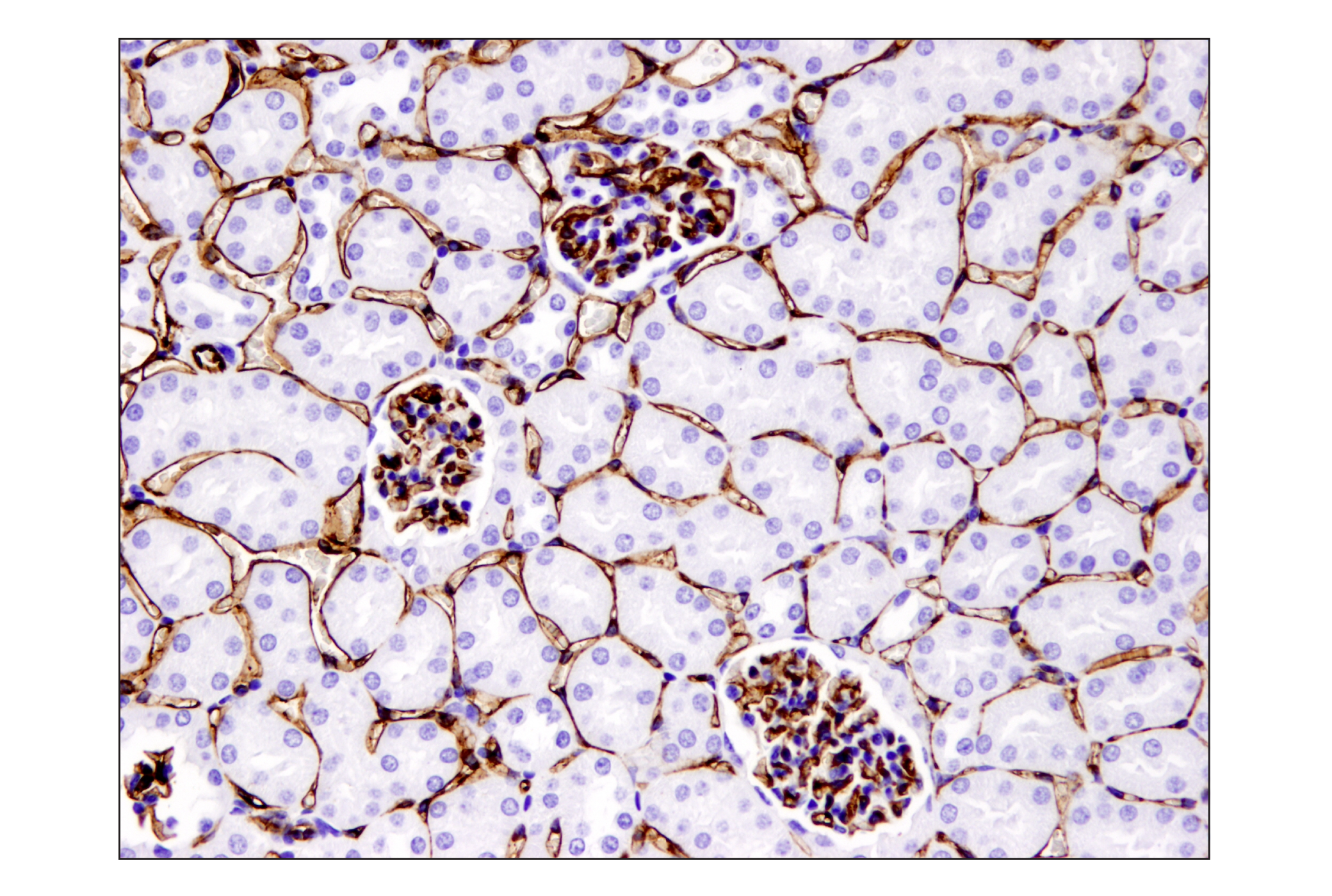 Immunohistochemistry Image 2: CD31 (PECAM-1) (D8V9E) XP® Rabbit mAb (BSA and Azide Free)