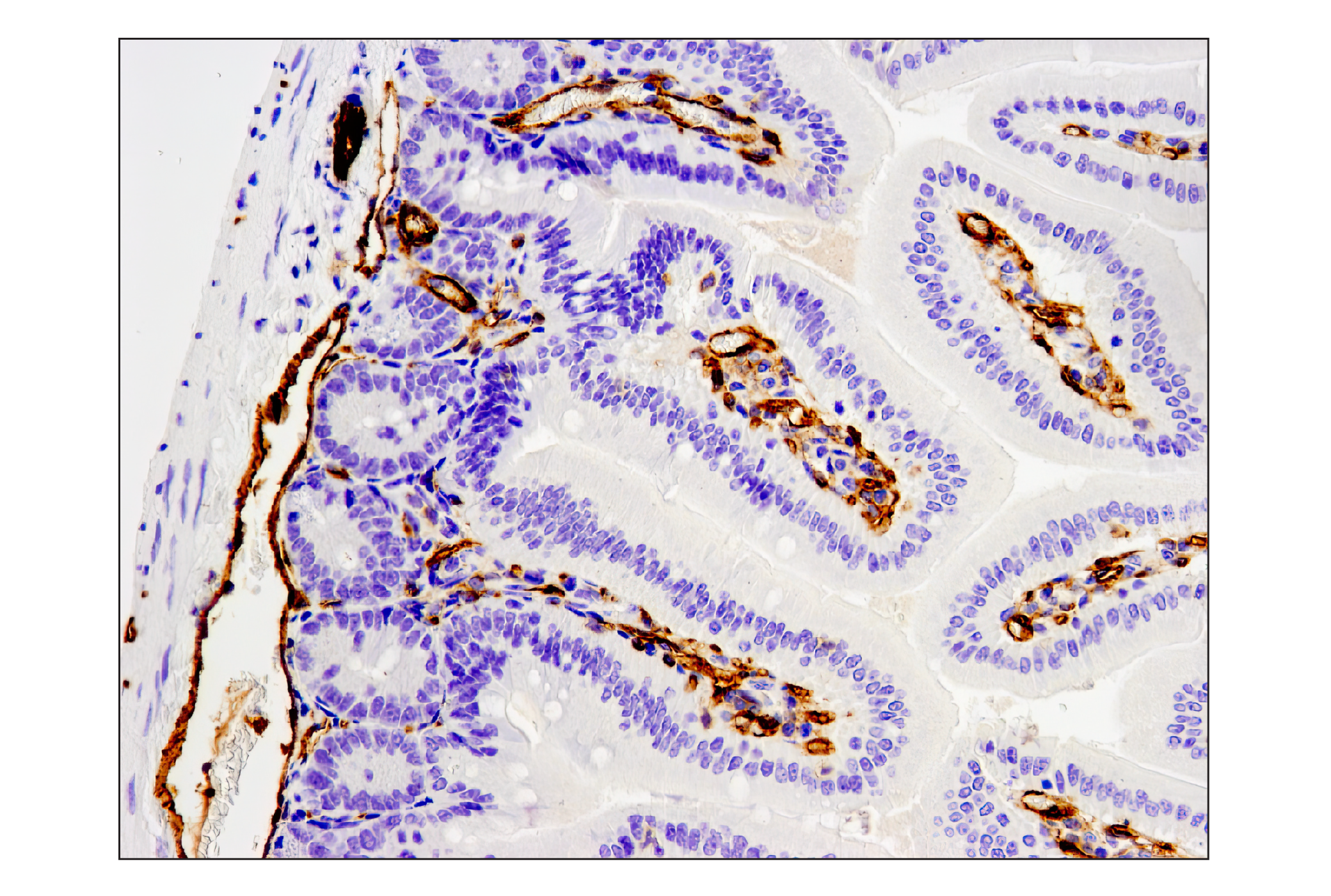 Immunohistochemistry Image 1: CD31 (PECAM-1) (D8V9E) XP® Rabbit mAb (BSA and Azide Free)