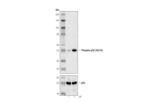  Image 11: Cell Cycle/Checkpoint Antibody Sampler Kit
