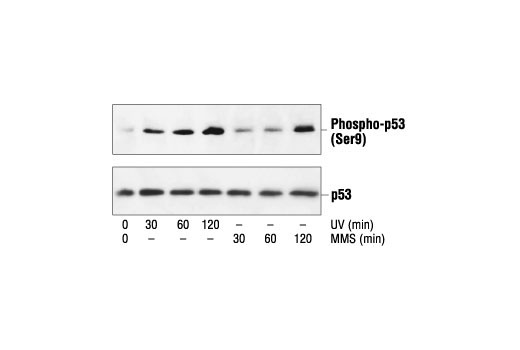  Image 11: p53 Antibody Sampler Kit