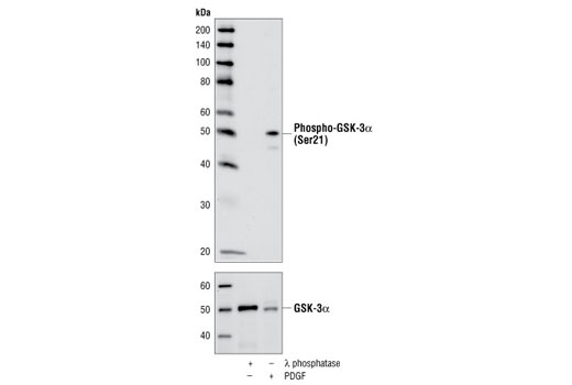  Image 11: Alzheimer's Disease Antibody Sampler Kit