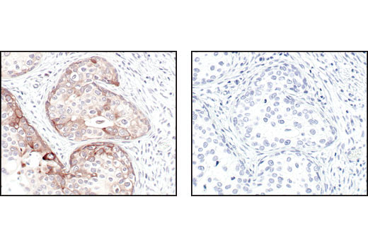  Image 18: Alzheimer's Disease Antibody Sampler Kit