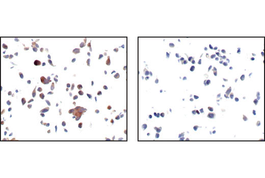  Image 23: Alzheimer's Disease Antibody Sampler Kit