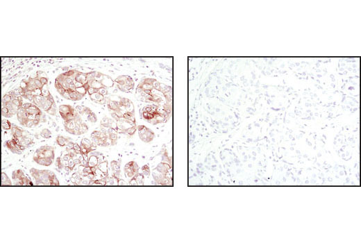  Image 25: Alzheimer's Disease Antibody Sampler Kit