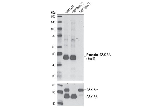 Western Blotting Image 2: Phospho-GSK-3-beta (Ser9) (D3A4) Rabbit mAb