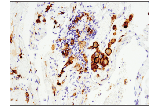  Image 19: Suppressive Myeloid Cell Phenotyping IHC Antibody Sampler Kit