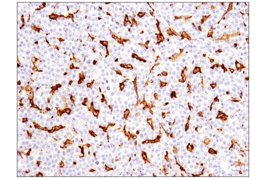  Image 44: Human Reactive M1 vs M2 Macrophage IHC Antibody Sampler Kit