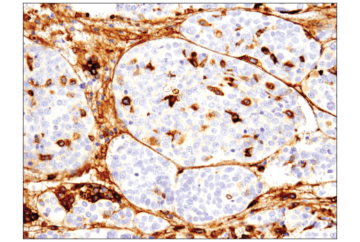  Image 49: Human Reactive M1 vs M2 Macrophage IHC Antibody Sampler Kit
