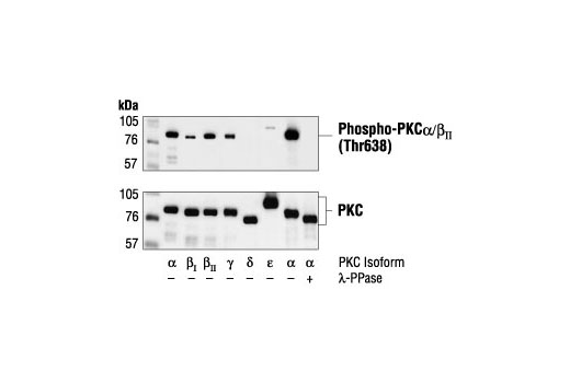  Image 14: Phospho-PKC Antibody Sampler Kit