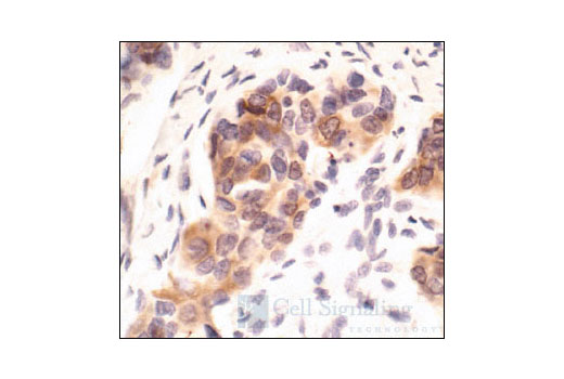  Image 18: Phospho-PKC Antibody Sampler Kit