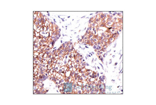 Immunohistochemistry Image 2: Phospho-Tyrosine Mouse mAb (P-Tyr-100)