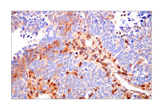 Immunohistochemistry Image 7: Phospho-Tyrosine Mouse mAb (P-Tyr-100)