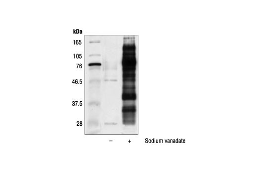 Immunoprecipitation Image 1: Phospho-Tyrosine Mouse mAb (P-Tyr-100) (Sepharose® Bead Conjugate)