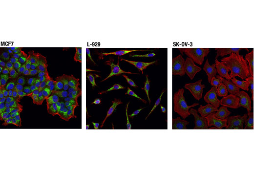  Image 24: Pro-Survival Bcl-2 Family Antibody Sampler Kit II