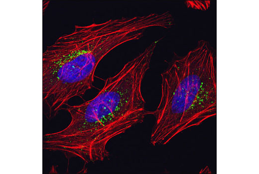  Image 16: mTOR Regulation Antibody Sampler Kit