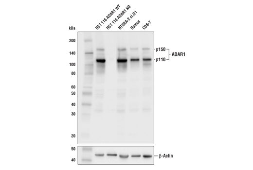 Western Blotting Image 1: ADAR1 (E6X9R) XP® Rabbit mAb (BSA and Azide Free)