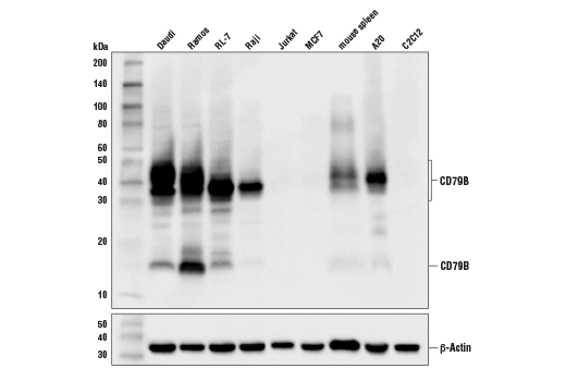 Western Blotting Image 1: CD79B (D7V2F) Rabbit mAb