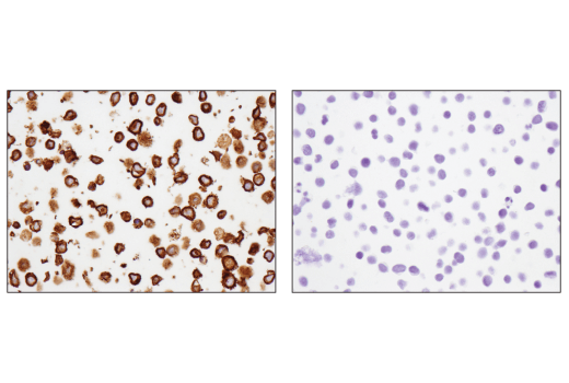 Immunohistochemistry Image 2: CD79B (D7V2F) Rabbit mAb