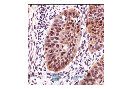 Immunohistochemistry Image 2: Phospho-Akt Substrate (RXXS*/T*) (110B7E) Rabbit mAb