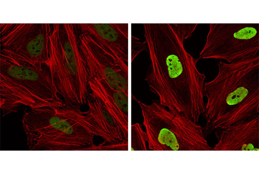  Image 37: Acetyl-Histone H3 Antibody Sampler Kit