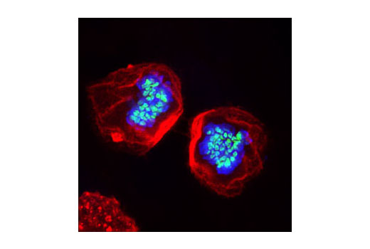  Image 16: Phospho-Histone H3 (Mitotic Marker) Antibody Sampler Kit
