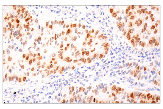 Immunohistochemistry Image 2: Phospho-Histone H2A.X (Ser139) (D7T2V) Mouse mAb (BSA and Azide Free)